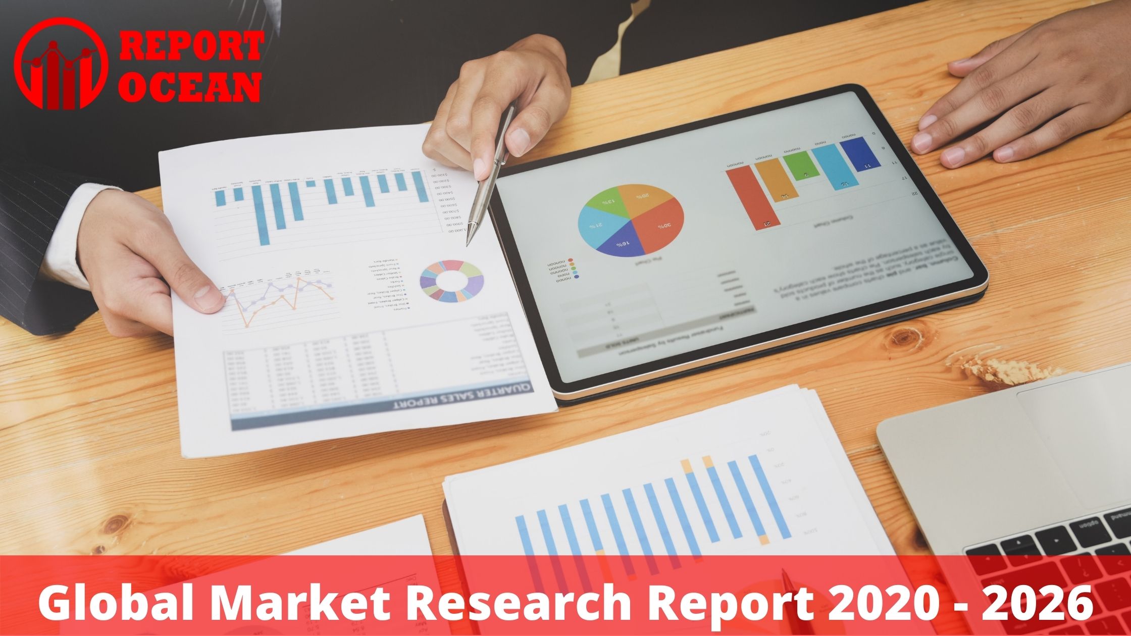 Global Kiteboarding Equipment Market By Covid-19 Impact Analysis, Size, Regional Growth, Major Key Players, Technology and Industry Trends till 2026 – The Think Curiouser